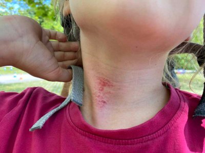 offenes Lenkerende am Fahrrad